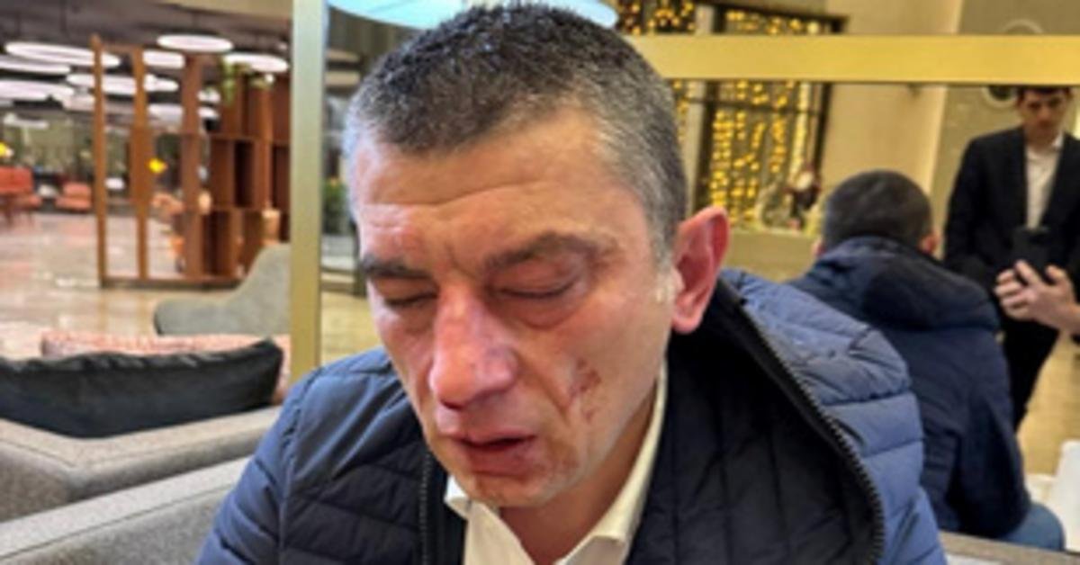 Giorgi Gakharia ellen tüntetett a grúz ellenzék Tbilisziben