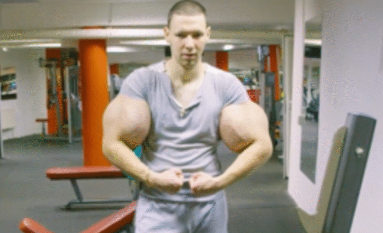 Orosz internetes sztár életveszélyben a túlzott izomnövelés miatt