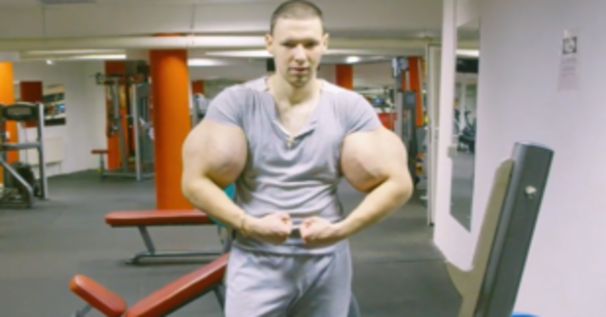 Orosz internetes sztár életveszélyben a túlzott izomnövelés miatt